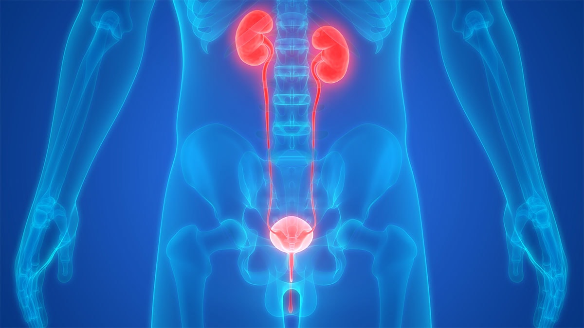 Bladder and Kidney Infections